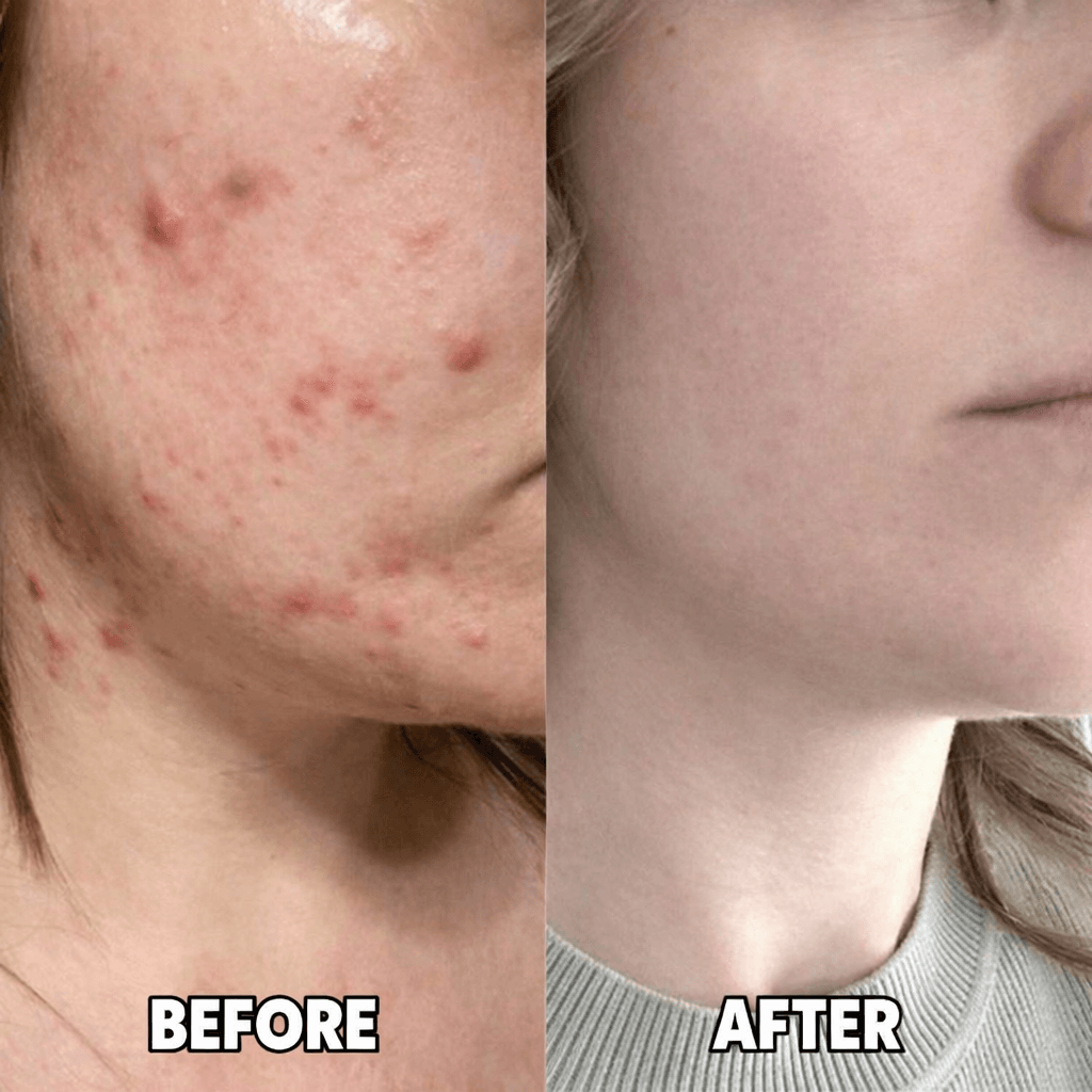 SeloraSkin Filtered Shower Head